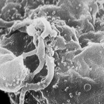 the HIV virus