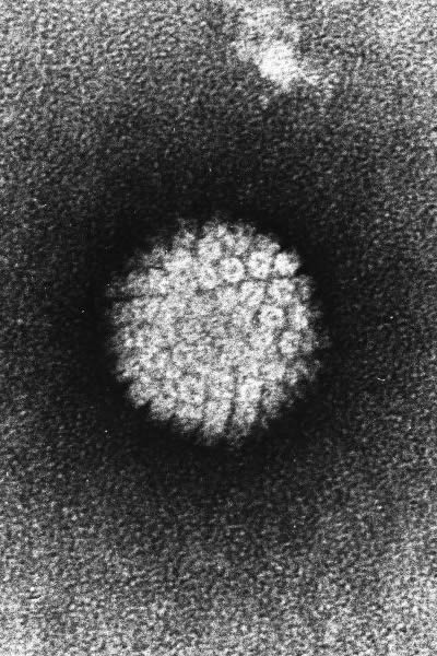 HPV, Human Papilloma Virus, gay news, Washington Blade