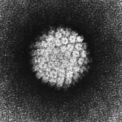 HPV, Human Papilloma Virus, gay news, Washington Blade