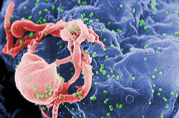 HIV, resistant, Human Immunodeficiency Virus, gay news, Washington Blade