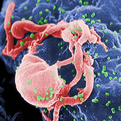 HIV, Human Immunodeficiency Virus, gay news, Washington Blade