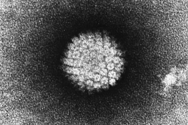 HPV, Human Papilloma Virus, gay news, Washington Blade