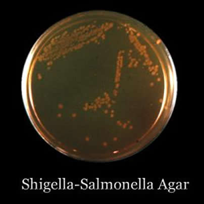 Shigella, bacteria, rimming, gay news, Washington Blade