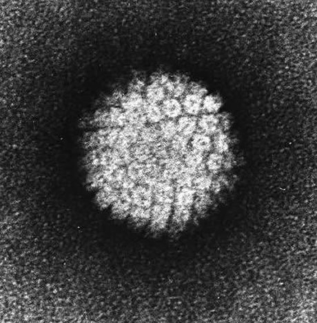 HPV, Human Papilloma Virus, gay news, Washington Blade