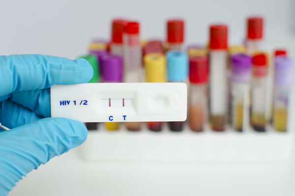 HIV rates, HIV testing, gay news, Washington Blade
