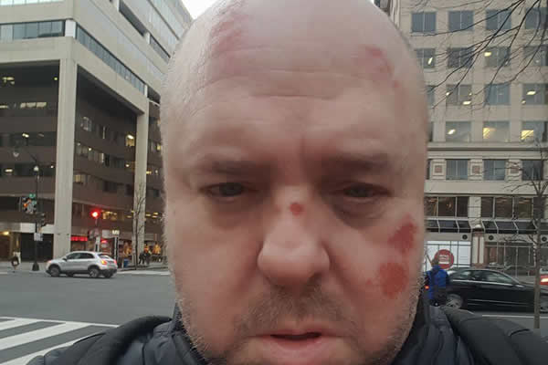 anti-gay attack, gay news, Trump supporters assault, Washington Blade, hate crime, Robert Richard Brice Kohler