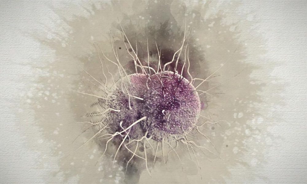 Cases of multidrug resistant gonorrhea 'super strain' multiply